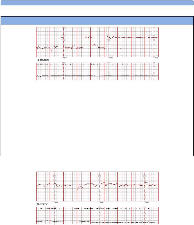 Philips OBTRNSBV1 User Manual