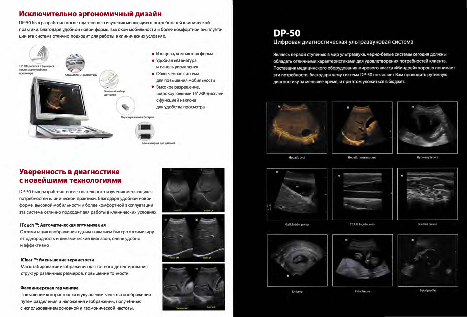 Mindray DP-50 Brochure