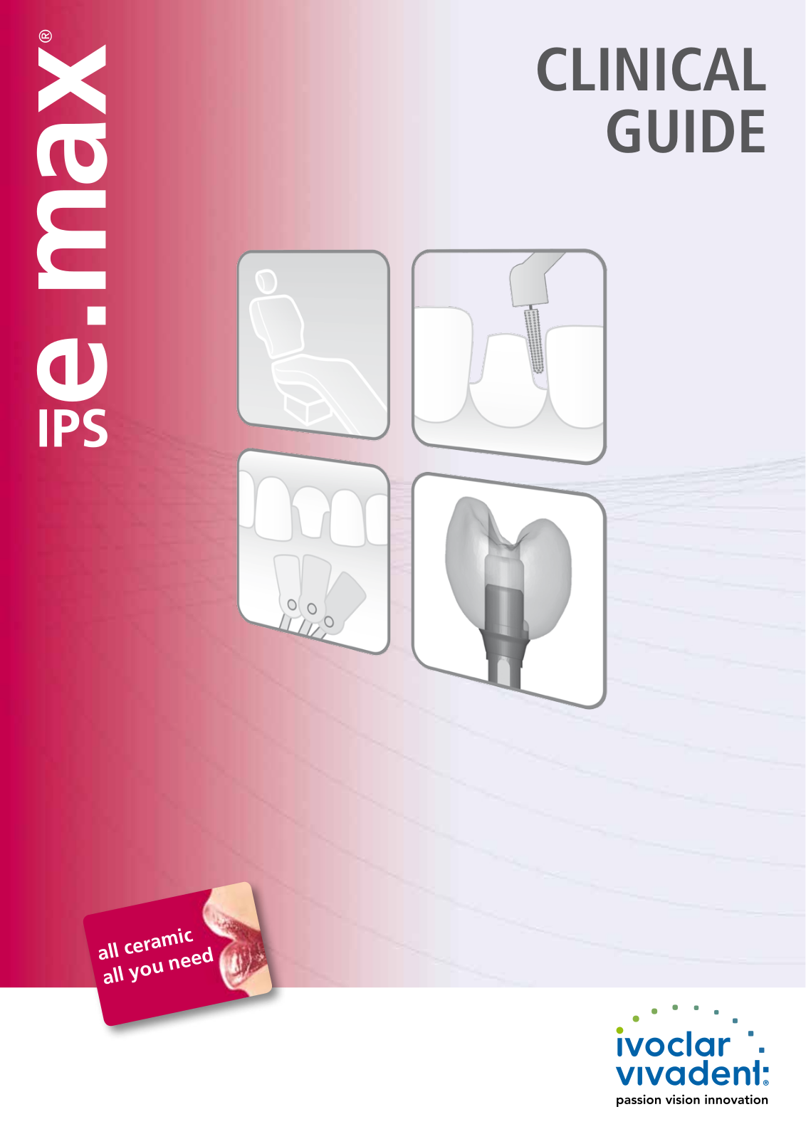 Ivoclar Vivadent IPS e.max Clinical User Manual